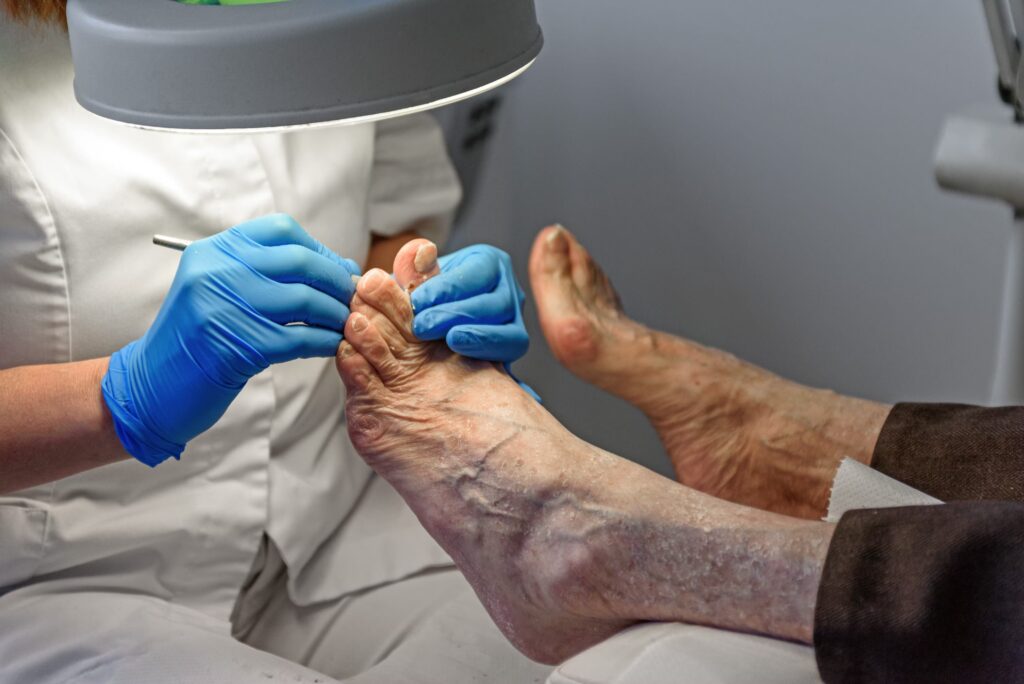 Diabetic Foot Care converted