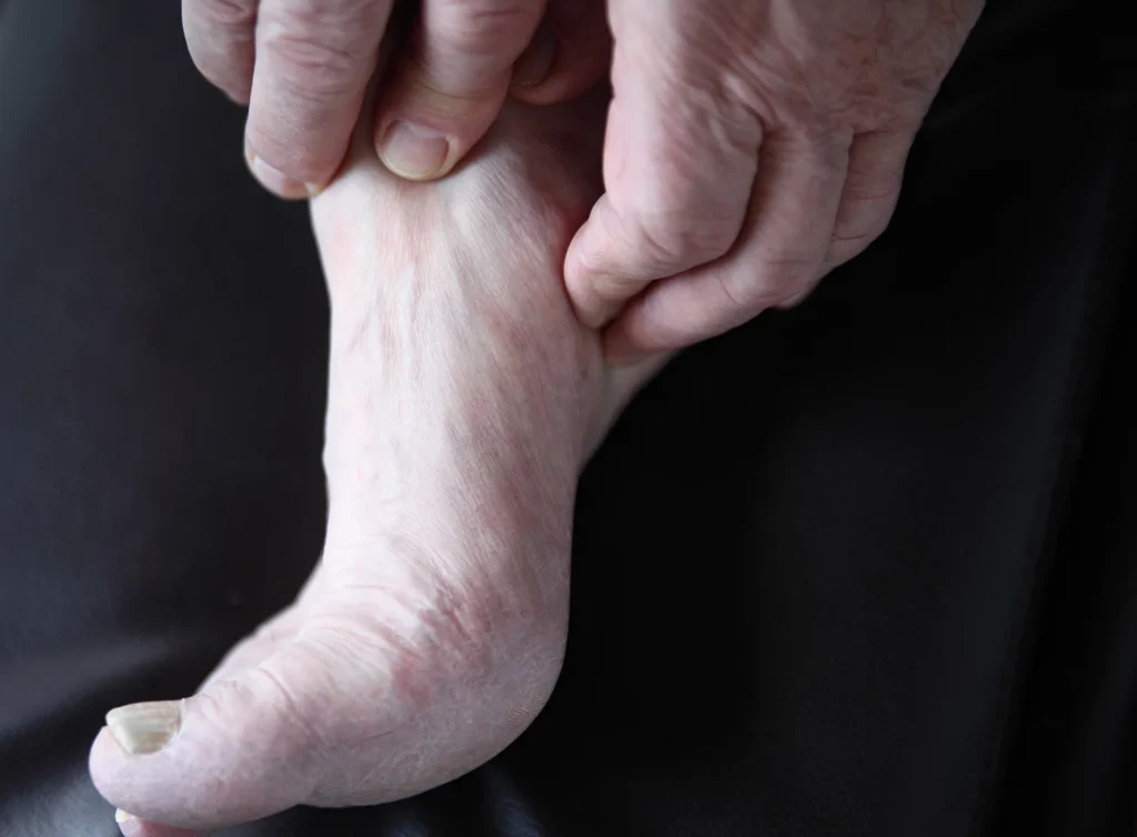 foot examined