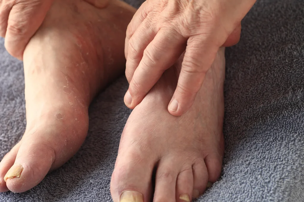 hand touching adult foot with visible
