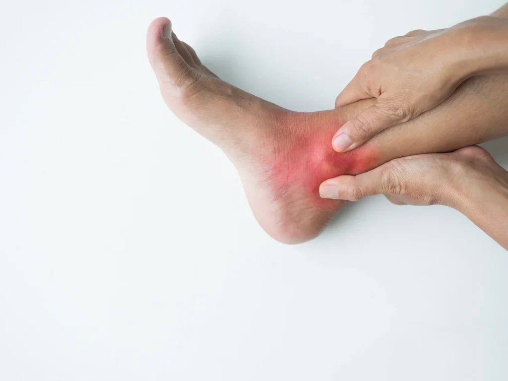 inflamed ankle with hands